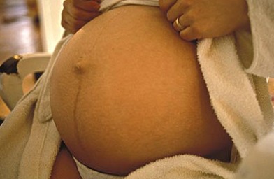 剖腹产和阴道分娩的比较分娩方式