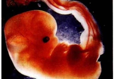 怀孕1个月：胎儿只是一个胚胎胎儿发育