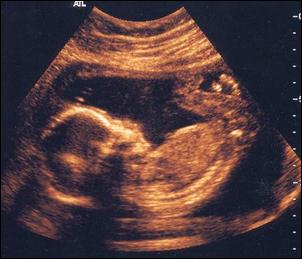 十大怀孕现象：男宝宝在子宫里勃起胎儿发育