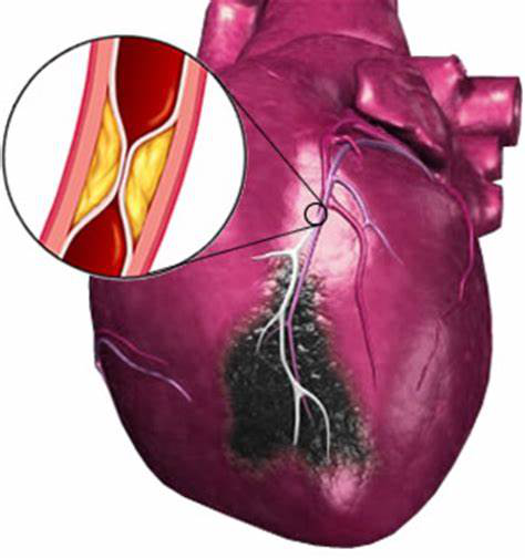 心梗的症状初期表现是什么，心梗是什么原因造成的，能预防吗？