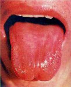 镜面红舌