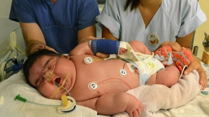 12斤女婴诞生破德国记录 警惕妊娠糖尿病致胎儿过重孕妇疾病