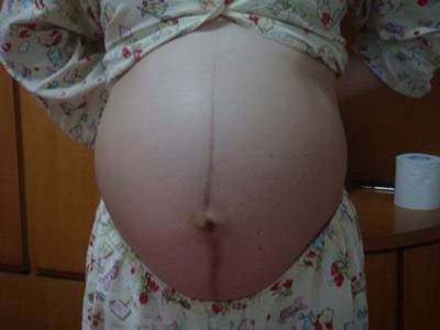 孕妇生女孩的肚子图片