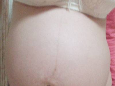 孕妇生女孩的肚子图片
