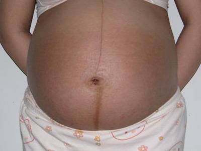 生男宝宝孕妇肚子形状图片