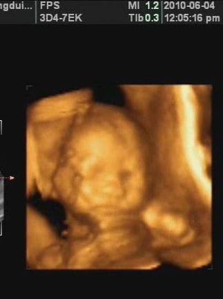 【怀孕22周】怀孕22周胎儿图 怀孕22周胎动及注意事项