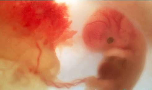 解读胎儿是否健康的12个“求救信号”