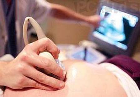 胎心率与宝宝性别  看胎心监护可分辨男孩女孩吗