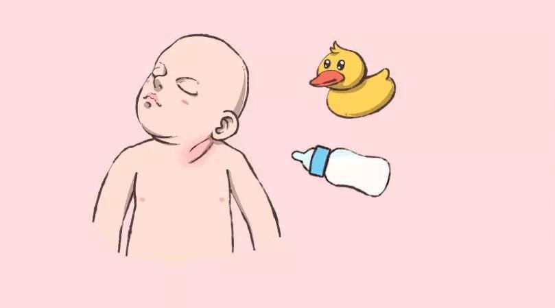 一个月新生儿斜颈的表现是什么，宝宝斜颈是因为孕期姿势吗？