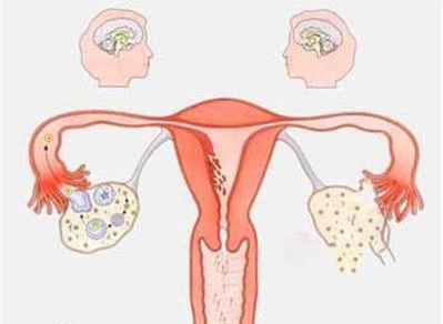 宫寒不孕的症状有哪些宫寒不孕不育的表现