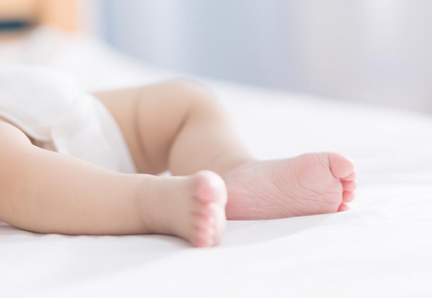 新生儿白色胎记是什么意思