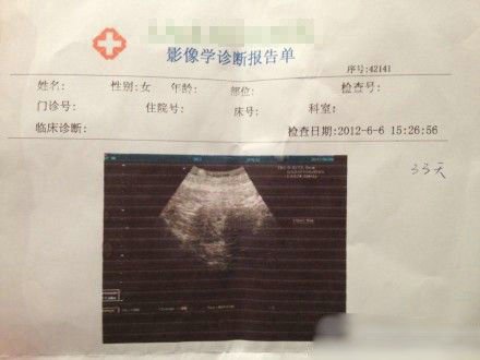 袁莉老公曝爱妻怀孕一个月 兴奋晒婴儿B超照