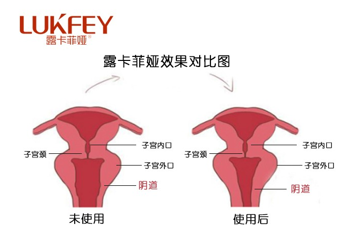 正规的缩阴产品有哪些（详细介绍）