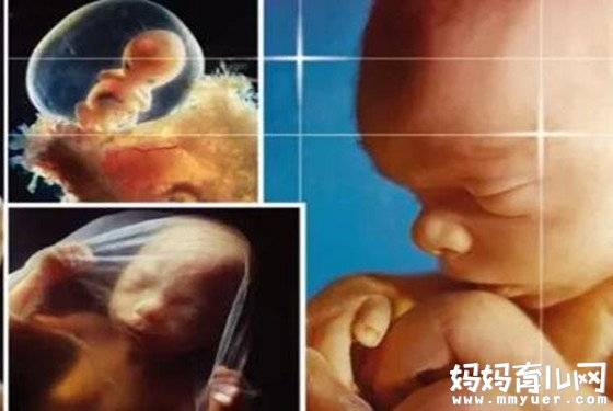 别疑惑了，怀孕五个月男胎儿图在B超看来就是酱纸！