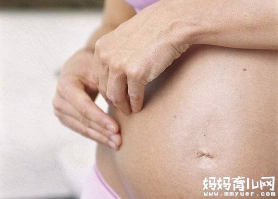 孕期肚子瘙痒难耐该咋办 妈妈须知导致肚子瘙痒的原因